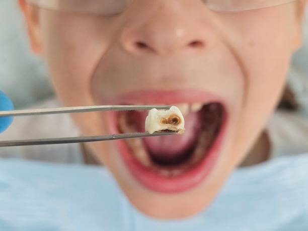 Best Emergency Broken Tooth Repair in Rio Verde, AZ
